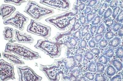 Immunohistochemistry-Paraffin: Histone H3 [Trimethyl Lys27] Antibody [NBP2-16840]